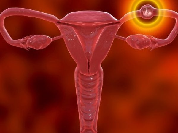 Dış Gebelik Nedir? Nasıl Tedavi Edilir?